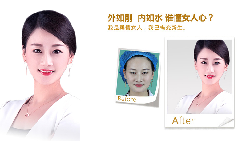汕头V脸、线雕隆鼻